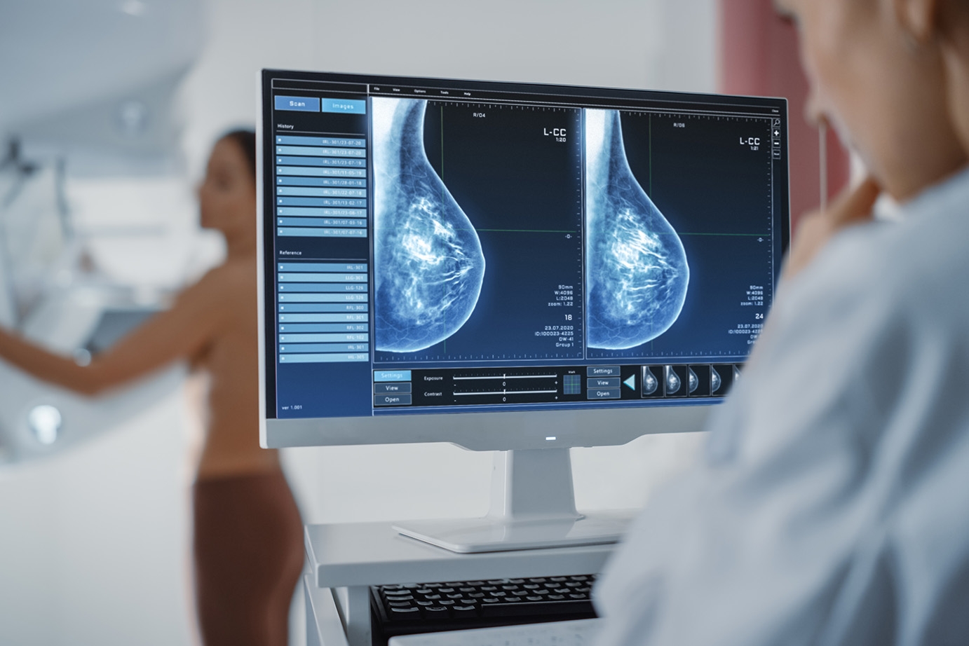 Mammographie/Brustdiagnostik