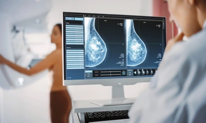 Mammographie-Screening-Zentrum