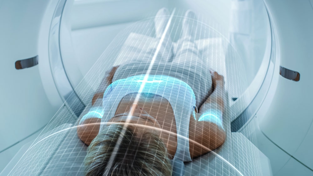 Patientin auf CT-Liege mit digitalem 3D-Gitternetz des Oberkörpers für KI-gestützte Analysen